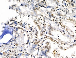 Invitrogen HEF1 Polyclonal Antibody 100 &mu;L | Buy Online | Invitrogen&trade; | Fisher Scientific