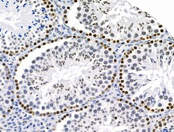 Invitrogen HEF1 Polyclonal Antibody 100 &mu;L | Buy Online | Invitrogen&trade; | Fisher Scientific