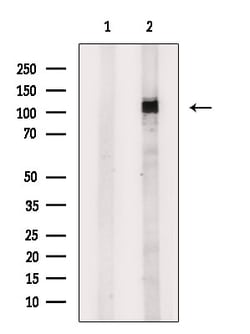 Invitrogen TNK2 Polyclonal Antibody 100 &mu;L | Buy Online | Invitrogen&trade; | Fisher Scientific