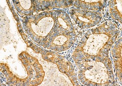 Invitrogen DKK3 Polyclonal Antibody 100 &mu;L; Unconjugated:Antibodies,