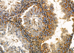 Invitrogen DKK3 Polyclonal Antibody 100 &mu;L; Unconjugated:Antibodies,