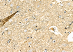 Invitrogen DKK3 Polyclonal Antibody 100 &mu;L; Unconjugated:Antibodies,