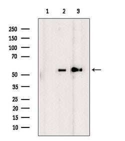 Invitrogen DKK3 Polyclonal Antibody 100 &mu;L; Unconjugated:Antibodies,