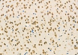 Invitrogen PCBP2 Polyclonal Antibody 100 &mu;L | Buy Online | Invitrogen&trade; | Fisher Scientific