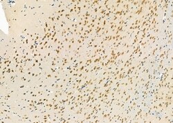 Invitrogen PCBP2 Polyclonal Antibody 100 &mu;L | Buy Online | Invitrogen&trade; | Fisher Scientific