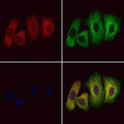 Invitrogen PRG2 Polyclonal Antibody 100 &mu;L; Unconjugated:Antibodies,