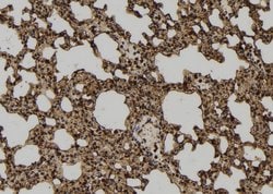 Invitrogen N-WASP Polyclonal Antibody 100 &mu;L; Unconjugated:Antibodies,