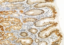 Invitrogen BTC Polyclonal Antibody 100 &mu;L | Buy Online | Invitrogen&trade; | Fisher Scientific