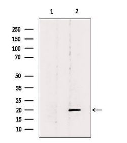 Invitrogen BTC Polyclonal Antibody 100 &mu;L | Buy Online | Invitrogen&trade; | Fisher Scientific