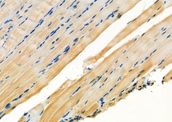 Invitrogen NDUFS1 Polyclonal Antibody 100 &mu;L | Buy Online | Invitrogen&trade; | Fisher Scientific