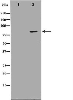 Invitrogen NDUFS1 Polyclonal Antibody 100 &mu;L | Buy Online | Invitrogen&trade; | Fisher Scientific