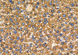 Invitrogen ALDH4A1 Polyclonal Antibody 100 &mu;L; Unconjugated:Antibodies,