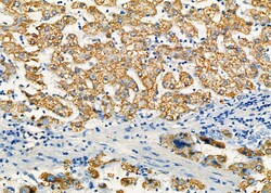 Invitrogen ALDH4A1 Polyclonal Antibody 100 &mu;L; Unconjugated:Antibodies,