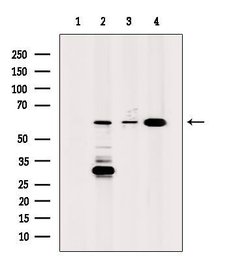 Invitrogen ALDH4A1 Polyclonal Antibody 100 &mu;L; Unconjugated:Antibodies,