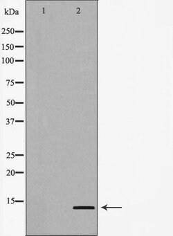 Invitrogen Eotaxin 2 Polyclonal Antibody 100 &mu;L | Buy Online | Invitrogen&trade; | Fisher Scientific