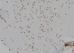 Invitrogen CDK20 Polyclonal Antibody 100 &mu;L | Buy Online | Invitrogen&trade; | Fisher Scientific