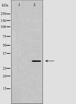 Invitrogen CDK20 Polyclonal Antibody 100 &mu;L | Buy Online | Invitrogen&trade; | Fisher Scientific