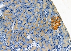 Invitrogen CLEC4D Polyclonal Antibody 100 &mu;L; Unconjugated:Antibodies,
