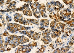 Invitrogen CLEC4A Polyclonal Antibody 100 &mu;L; Unconjugated:Antibodies,