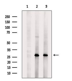 Invitrogen CLEC4A Polyclonal Antibody 100 &mu;L; Unconjugated:Antibodies,