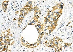 Invitrogen FAM81B Polyclonal Antibody 100 &mu;L; Unconjugated:Antibodies,