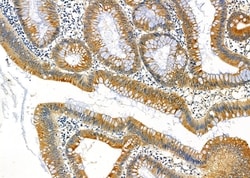 Invitrogen FAM81B Polyclonal Antibody 100 &mu;L; Unconjugated:Antibodies,