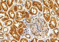 Invitrogen FAM81B Polyclonal Antibody 100 &mu;L; Unconjugated:Antibodies,