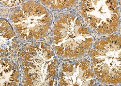 Invitrogen FAM81B Polyclonal Antibody 100 &mu;L; Unconjugated:Antibodies,