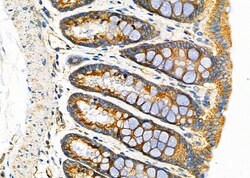 Invitrogen FAM81B Polyclonal Antibody 100 &mu;L; Unconjugated:Antibodies,