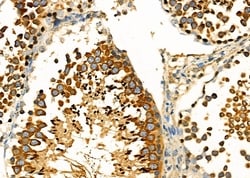 Invitrogen FAM81B Polyclonal Antibody 100 &mu;L; Unconjugated:Antibodies,