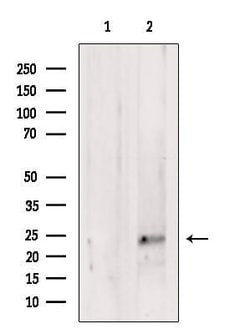 Invitrogen NeuroG3 Polyclonal Antibody 100 &mu;L | Buy Online | Invitrogen&trade; | Fisher Scientific