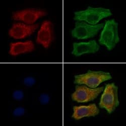 Invitrogen LAMP3 Polyclonal Antibody 100 &mu;L | Buy Online | Invitrogen&trade; | Fisher Scientific
