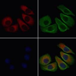 Invitrogen ENPP7 Polyclonal Antibody 100 &mu;L; Unconjugated:Antibodies,