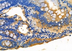 Invitrogen ENPP7 Polyclonal Antibody 100 &mu;L; Unconjugated:Antibodies,