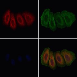 Invitrogen GLRA1 Polyclonal Antibody 100 &mu;L; Unconjugated:Antibodies,