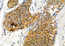 Invitrogen GLRA1 Polyclonal Antibody 100 &mu;L; Unconjugated:Antibodies,
