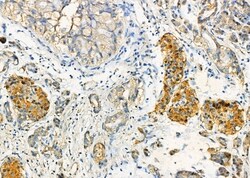 Invitrogen GLRA1 Polyclonal Antibody 100 &mu;L; Unconjugated:Antibodies,