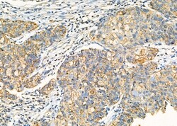 Invitrogen GLRA1 Polyclonal Antibody 100 &mu;L; Unconjugated:Antibodies,