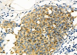 Invitrogen GLRA1 Polyclonal Antibody 100 &mu;L; Unconjugated:Antibodies,