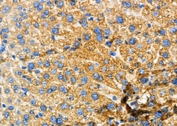 Invitrogen GLRA1 Polyclonal Antibody 100 &mu;L; Unconjugated:Antibodies,