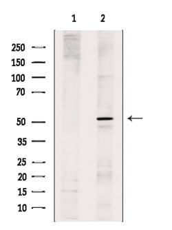 Invitrogen GLRA1 Polyclonal Antibody 100 &mu;L; Unconjugated:Antibodies,