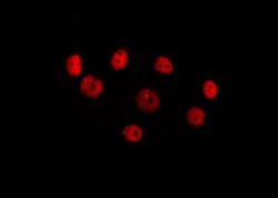 Invitrogen HOXC8 Polyclonal Antibody 100 &mu;L; Unconjugated:Antibodies,