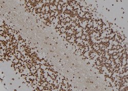 Invitrogen HOXC8 Polyclonal Antibody 100 &mu;L; Unconjugated:Antibodies,