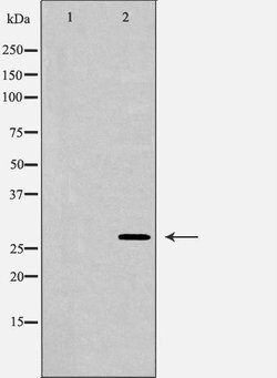 Invitrogen HOXC8 Polyclonal Antibody 100 &mu;L; Unconjugated:Antibodies,