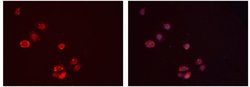 Invitrogen IGFBP7 Polyclonal Antibody 100 &mu;L; Unconjugated:Antibodies,