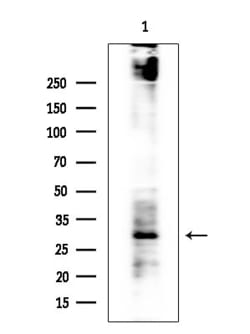 Invitrogen IGFBP7 Polyclonal Antibody 100 &mu;L; Unconjugated:Antibodies,