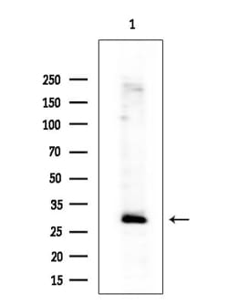 Invitrogen IGFBP7 Polyclonal Antibody 100 &mu;L; Unconjugated:Antibodies,