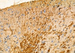 Invitrogen Kallikrein 5 Polyclonal Antibody 100 &mu;L; Unconjugated:Antibodies,