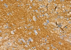 Invitrogen Kallikrein 5 Polyclonal Antibody 100 &mu;L; Unconjugated:Antibodies,