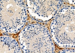 Invitrogen Luteinizing Hormone-beta Polyclonal Antibody 100 &mu;L; Unconjugated:Antibodies,